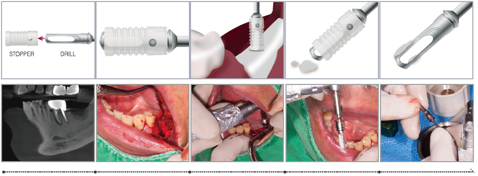 بن کلکتور dental studio